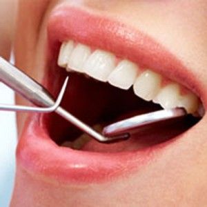 پوسیده شدن دندان با وجود مسواک و نخ دندان