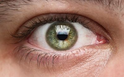 ارتباط ژن ها با ریسک ابتلا به سرطان چشم