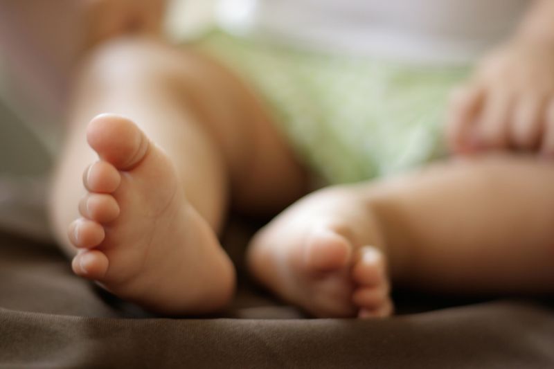 پای پرانتزی را در کودکی درمان کنید