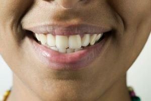 آیا مسواک زدن برای پیشگیری ازپوسیدگی دندان کافی است؟