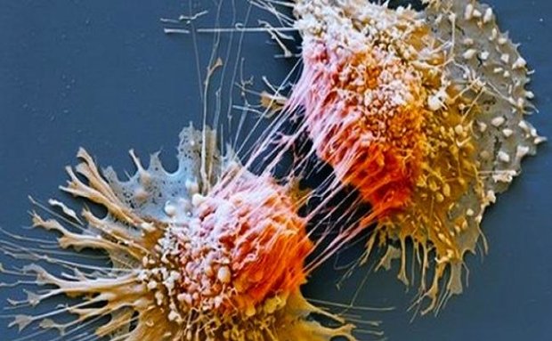 کشف پروتئینی که روند گسترش سرطان را کاهش می دهد