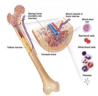 علائم و راههای درمان سرطان استخوان