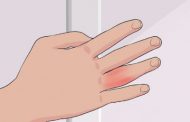 راههای تشخیص پیچ خوردگی (رگ به رگ شدن) انگشت