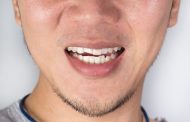 درمان دندان قروچه با روش های خانگی