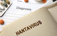 هانتا ویروس چیست؟ علایم و درمان هانتا ویروس