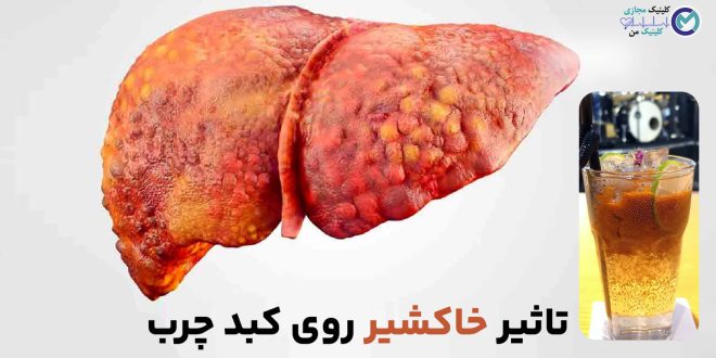 The-effect-of-descurainia-sophia-on-fatty-liver