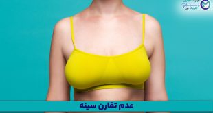 Breast-asymmetry