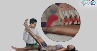 Treatment-of-diseases-with-the-help-of-physiotherapy
