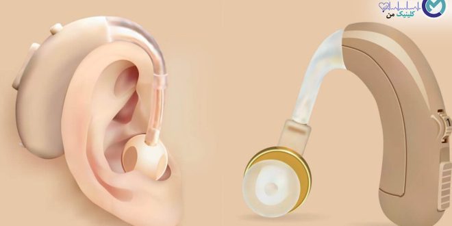 hearing-aids