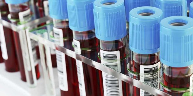 blood-test