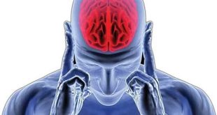 Stroke-in-young-people