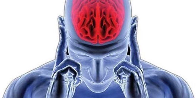 Stroke-in-young-people