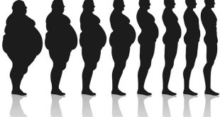 Obesity-Treatment